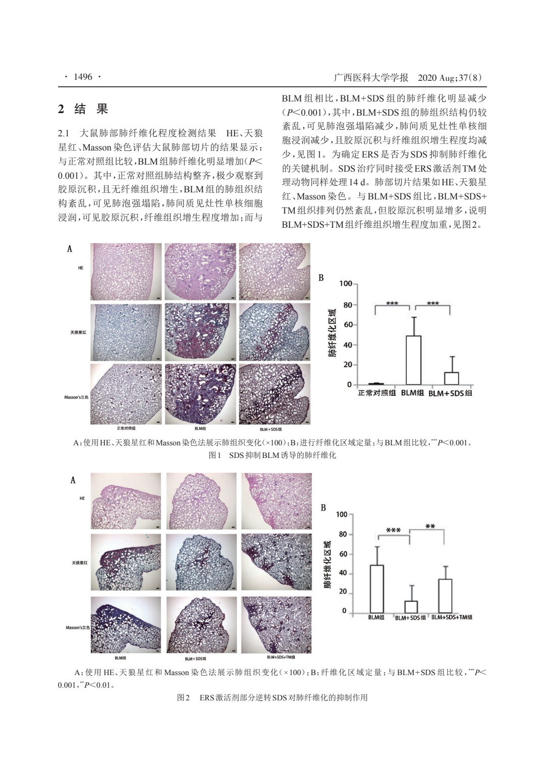紅景天苷對肺纖維化的作用及機制研究_2.jpeg